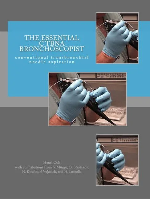 The Essential cTBNA Bronchoscopist cover